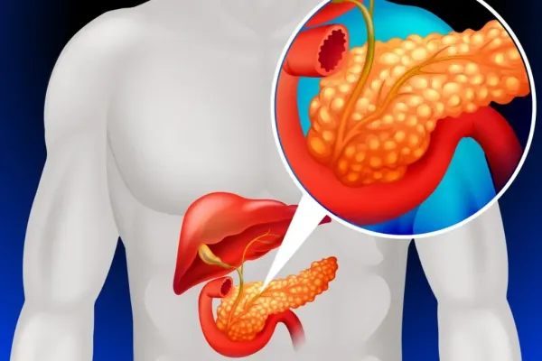 AKUT VE KRONİK PANKREATİTLER